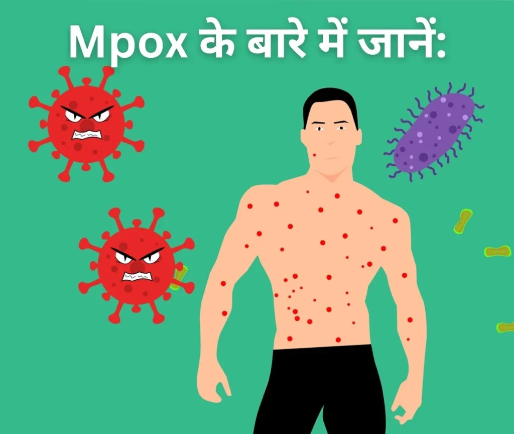 मंकीपॉक्स वायरस, Mpox